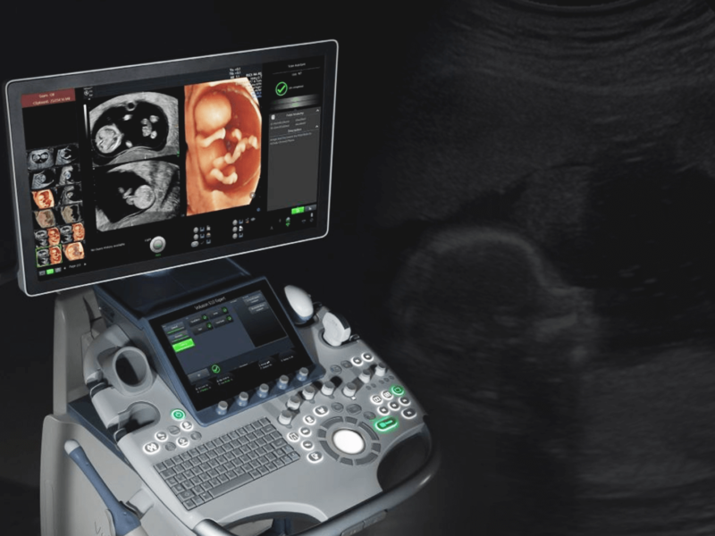 ultrassonografia