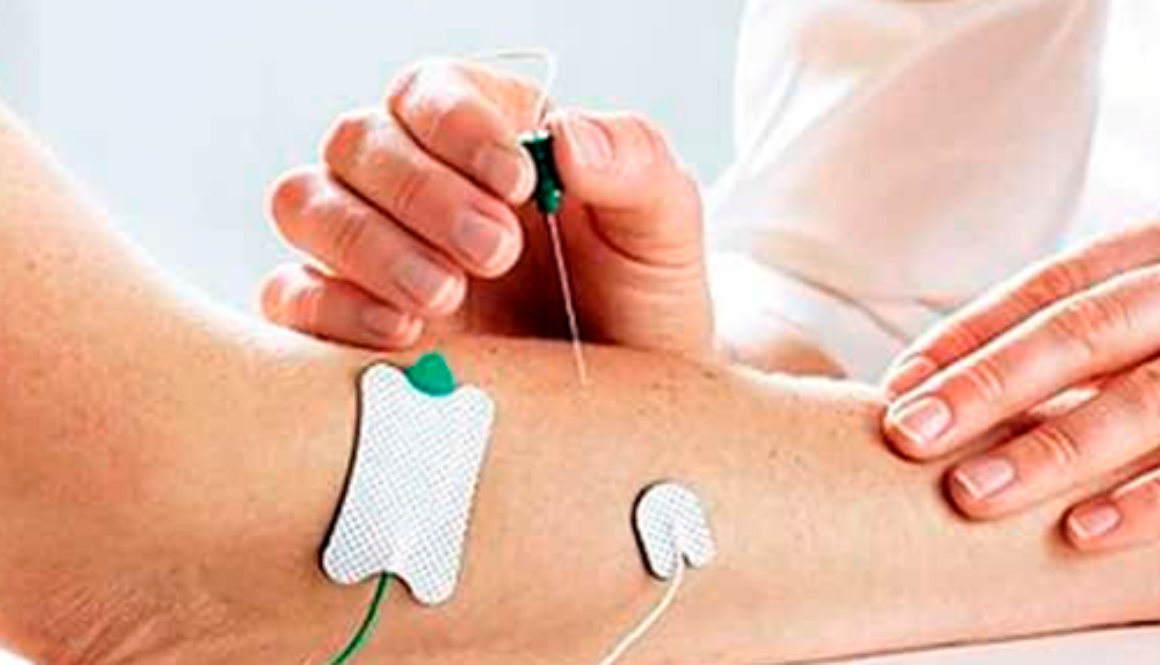 eletroneuromiografia