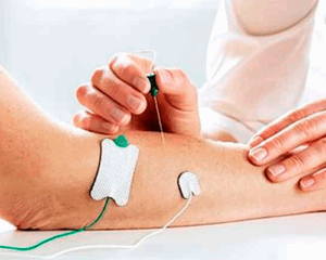 eletroneuromiografia eletroneuromiografia